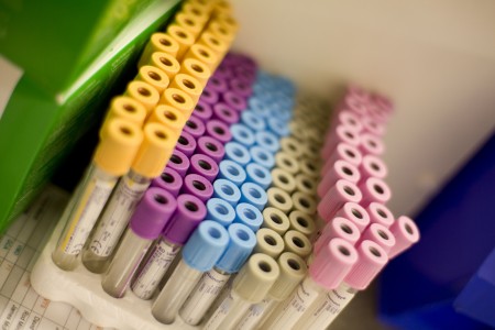 A tray full of test samples.