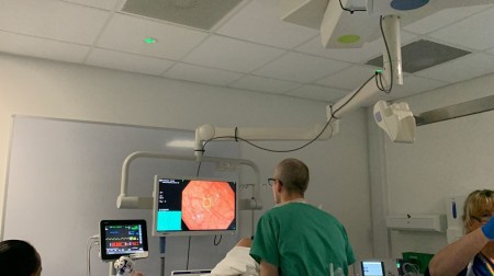 The GI Genius in use during a colonosopy. A doctor is looking at a screen.