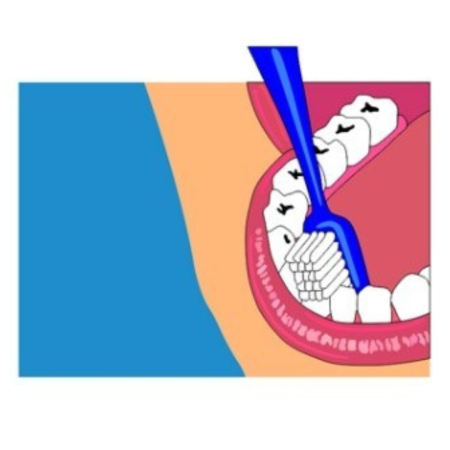 A diagram of brushing teeth.