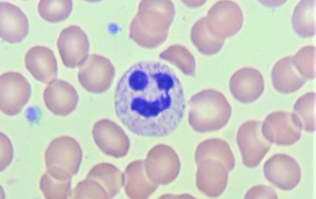 haematology.jpg