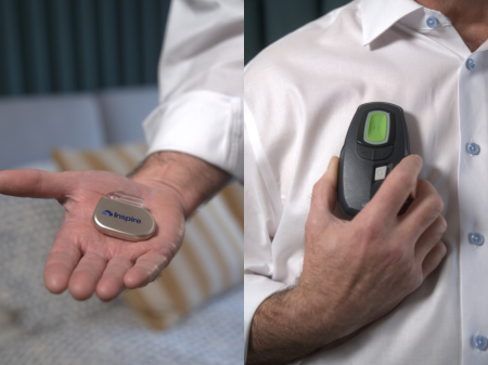 Inspire_OSA_Pacemaker-Scale.png