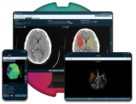 A photograph of phone, computer and tablet, each showing scans of the brain.